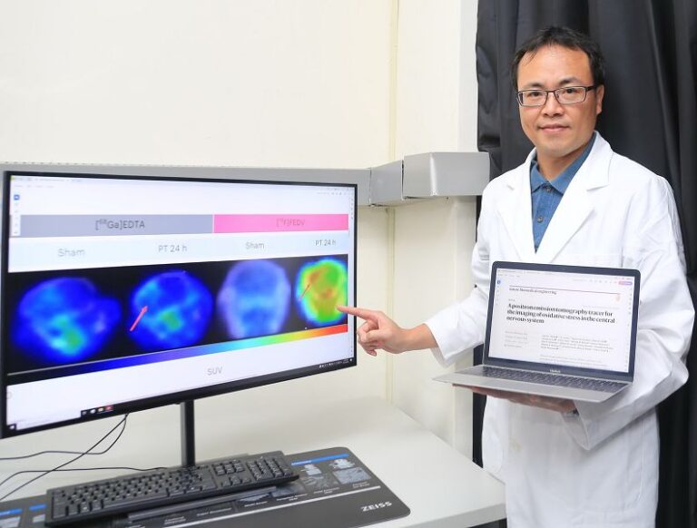 中山大學研究全球首創氧化壓力偵測技術 有望緩解阿茲海默症